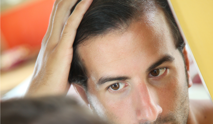 transplantes-capilares