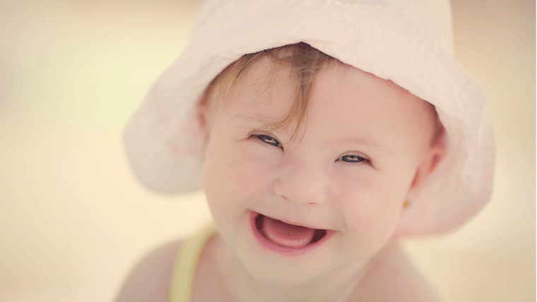 trissomia-21-criancas-especiais-a-conquista-da-felicidade