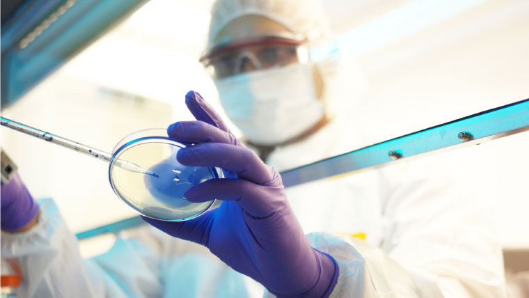 o-que-e-o-virus-ebola