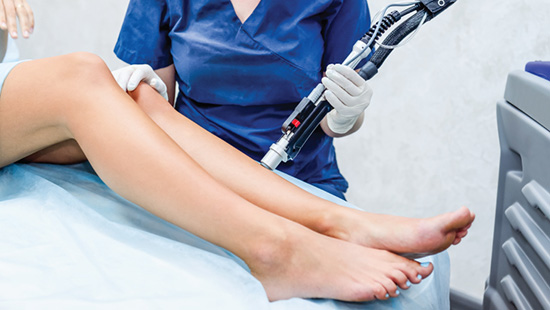 depilacao-laser_redimensionado