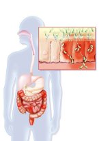 doença de Crohn